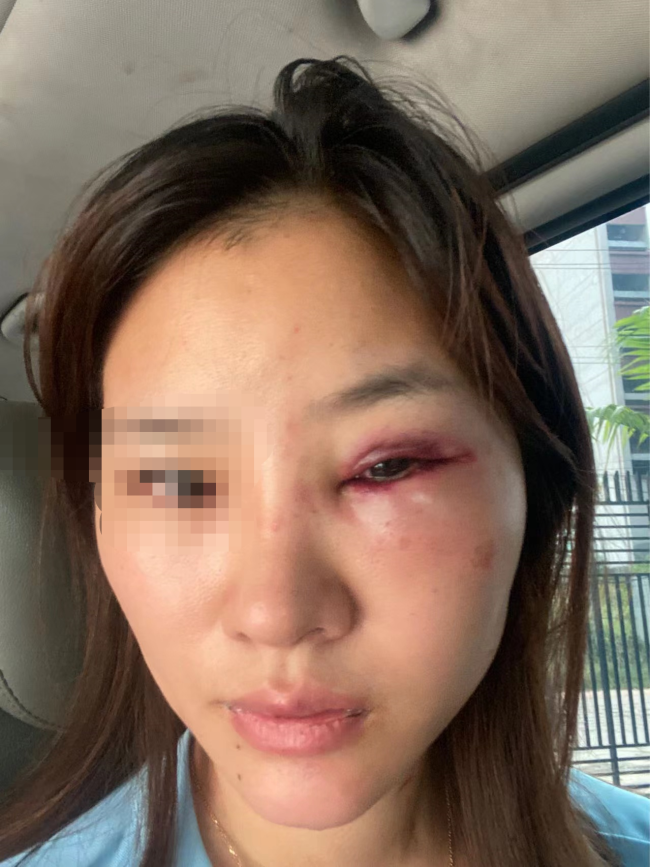 女子柬埔寨遭性侵报警要付小费  被殴打多处受伤回国受阻