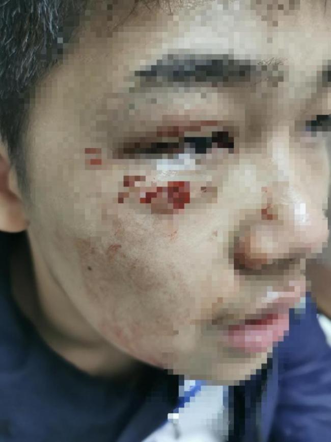 男子撞伤学生后逃逸被抓 北京警方：事故正调查处理中