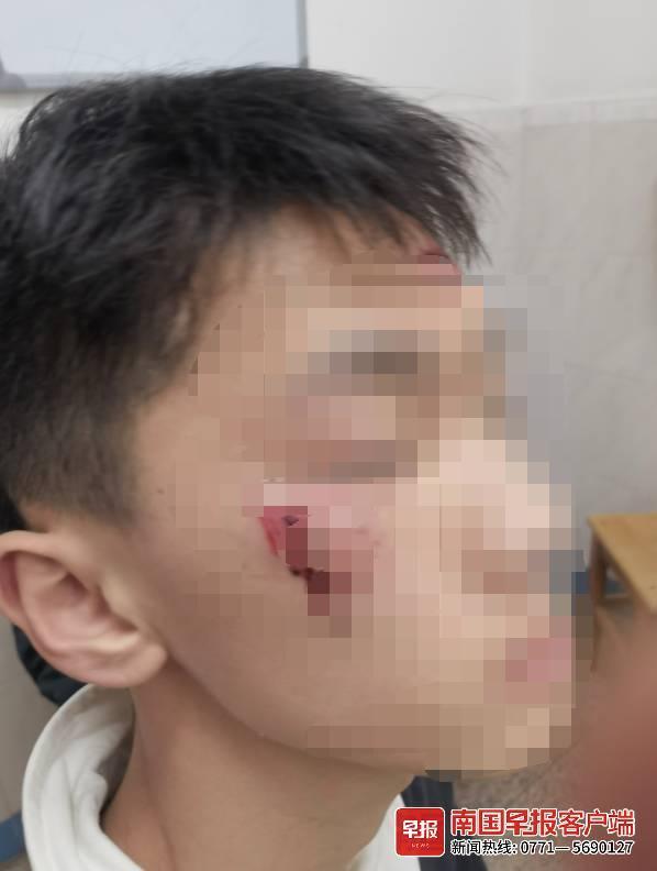 南宁一中职学生被教员殴打，时隔一个多月未给说法 家长：将起诉学校